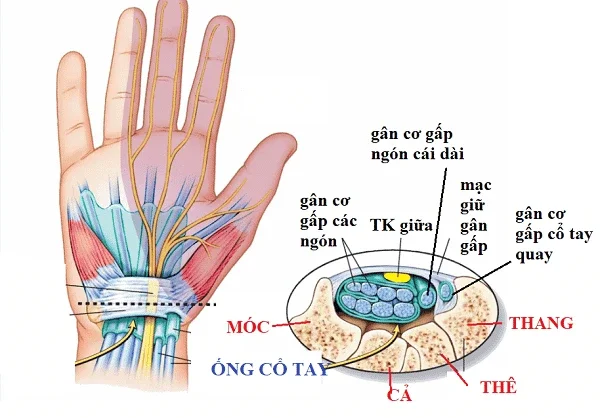 Sơ đồ giải phẫu dây thần kinh giữa bị chèn ép bên dưới dây chằng vòng cổ tay